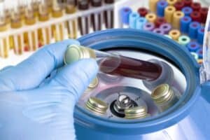 Blood Test Pathogen What Are the Most Common Bloodborne Pathogens?