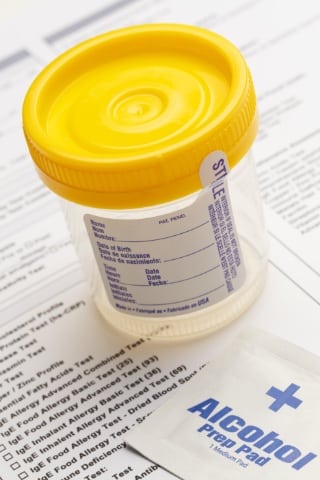 Urine Sample for Drug Test