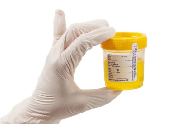 Urine Test Container