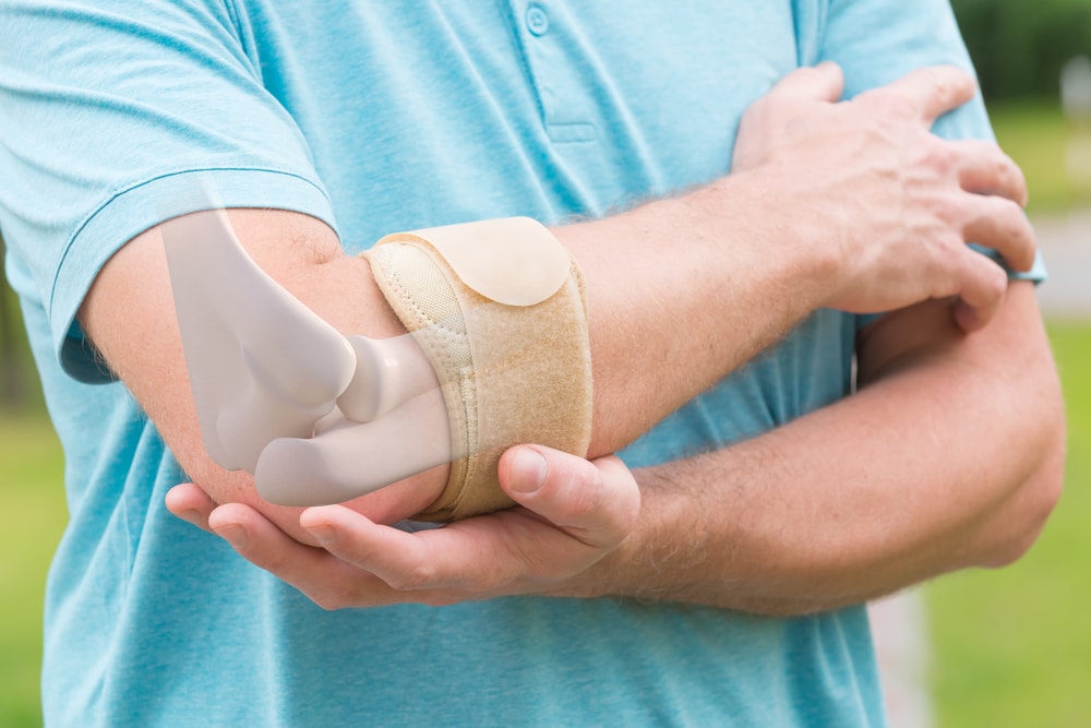 Man wearing a brace because he has Tennis Elbow