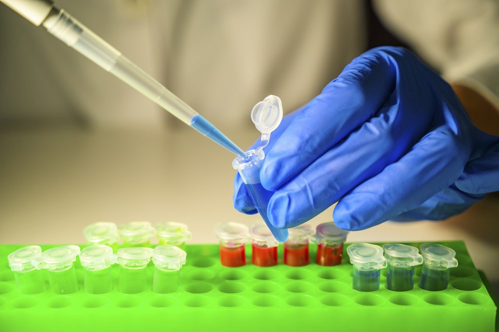 Lab worker Testing Tubes of Chemicals